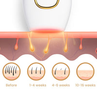KAAZ ™ IPL Hair Remover