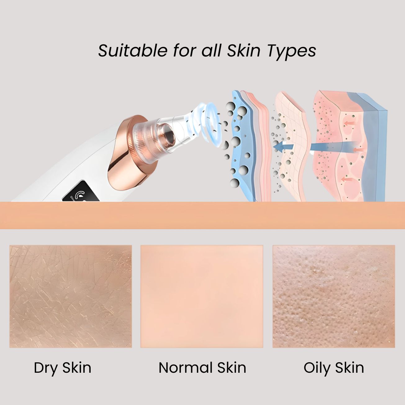 KAAZ ™ Blackhead Remover