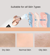 KAAZ ™ Blackhead Remover
