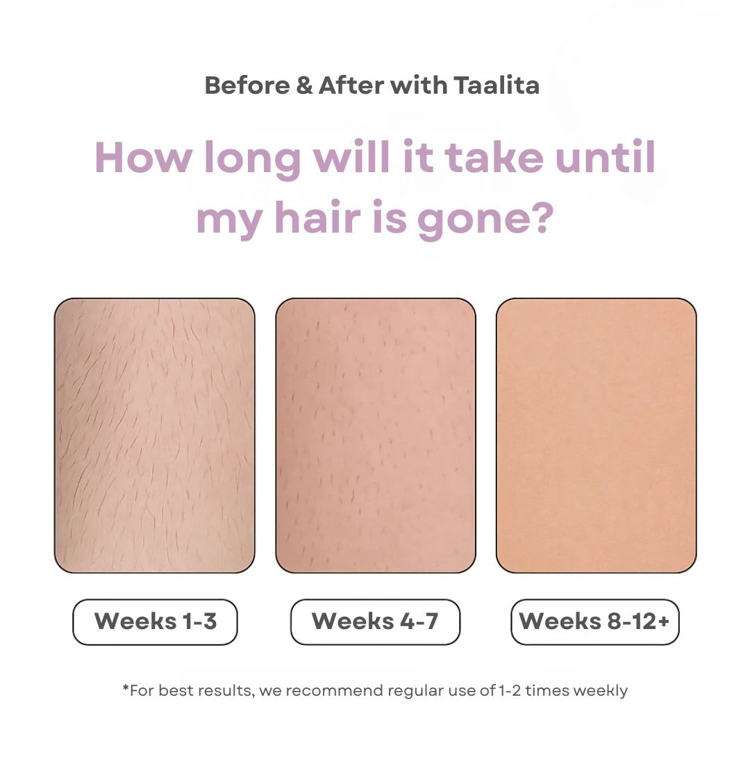 KAAZ ™ IPL Hair Remover | Hair-Free Skin in Just Weeks