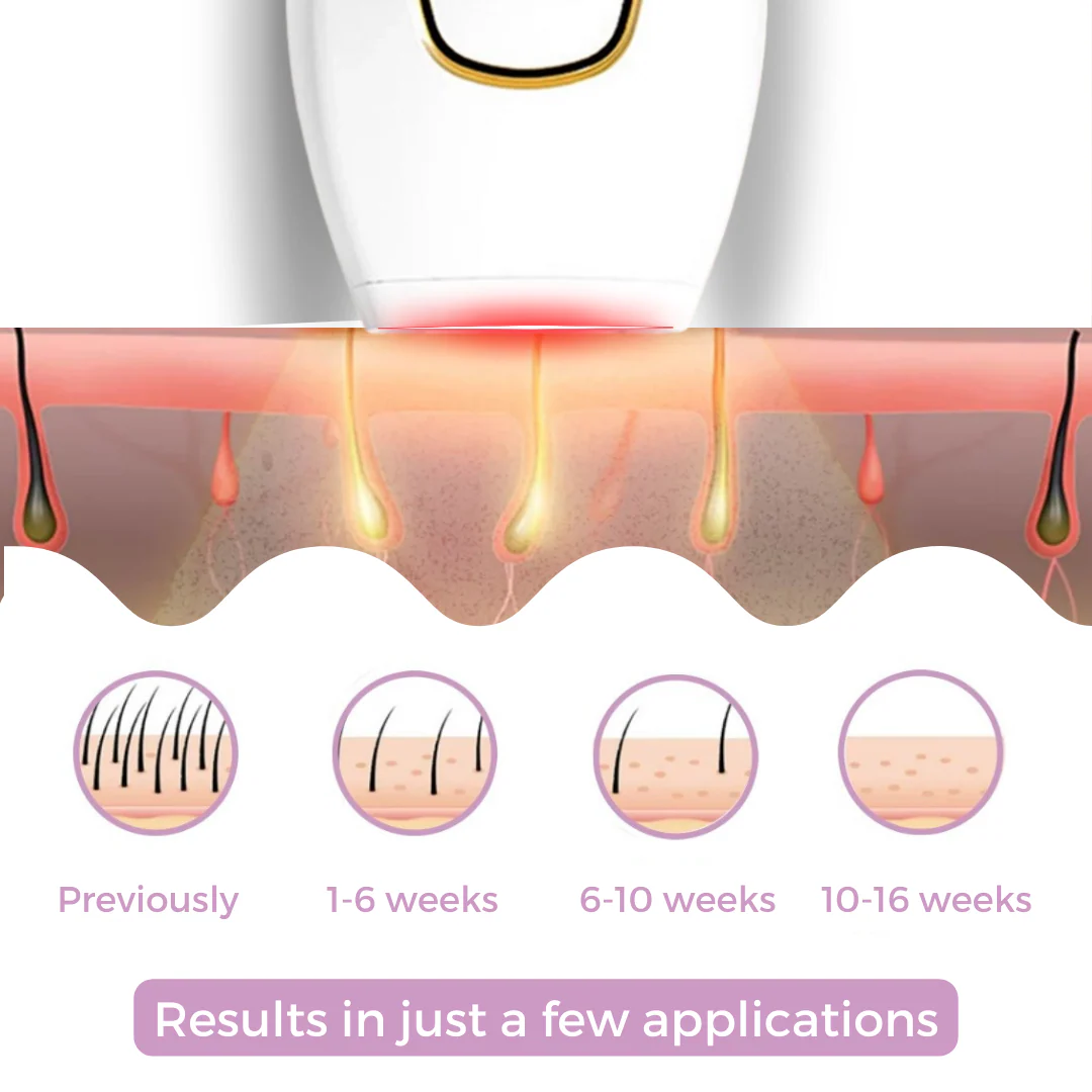 KAAZ ™ IPL Hair Remover | Hair-Free Skin in Just Weeks